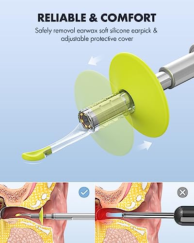 Anykit Digital Otoscope with Gyroscope, 4.5" Screen, Ear Wax Removal Tool C80173
