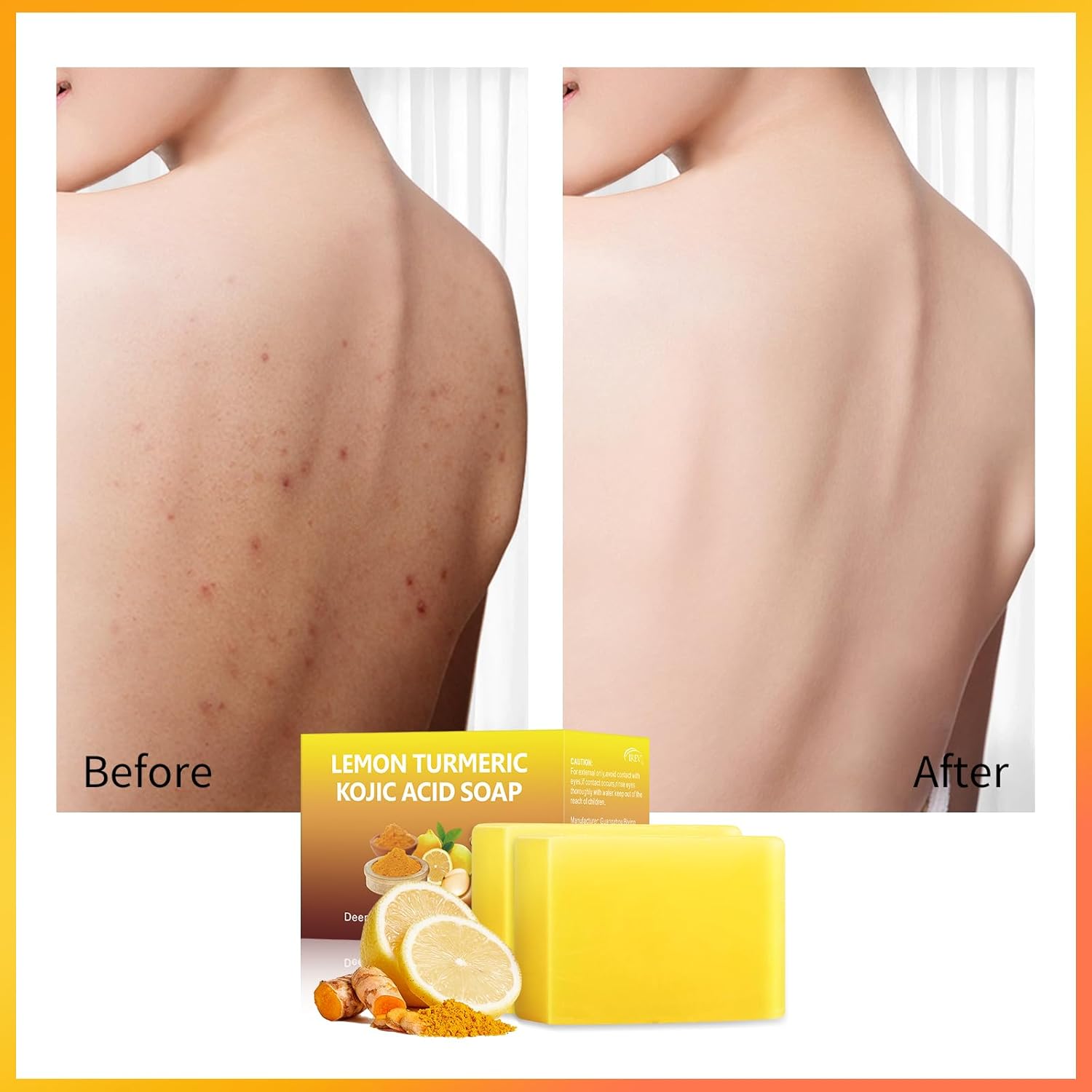 Tamoskiny Lemon Turmeric Kojic Acid Soap Bar for Hyperpigmentation, 2 Pack K75405