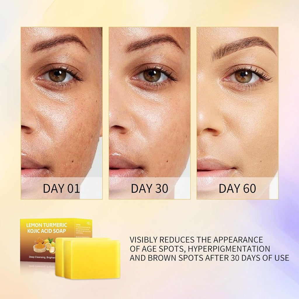Tamoskiny Lemon Turmeric Kojic Acid Soap Bar for Hyperpigmentation, 2 Pack K75405